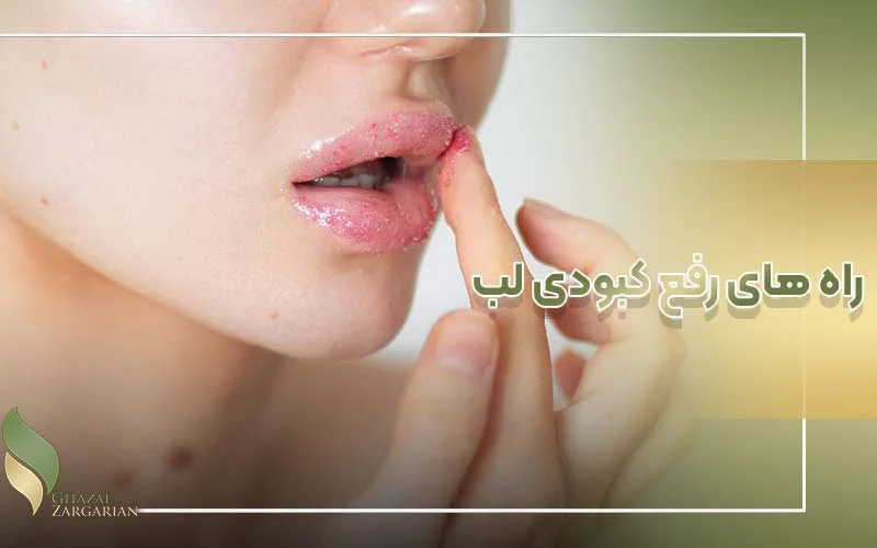 بهترین پماد برای رفع تیرگی لب