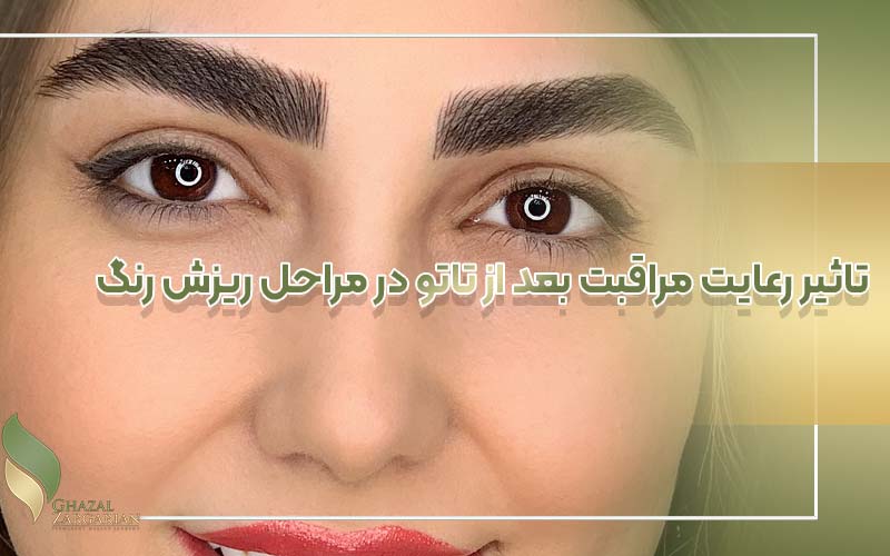 ریزش رنگ تاتو بدن