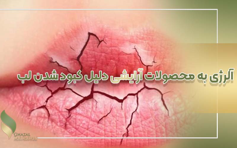 علت کبودی لب زنان نی نی سایت