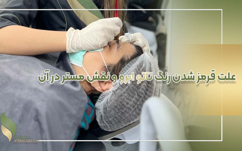 دلیل رنگ نگرفتن فیبروز ابرو نی نی سایت