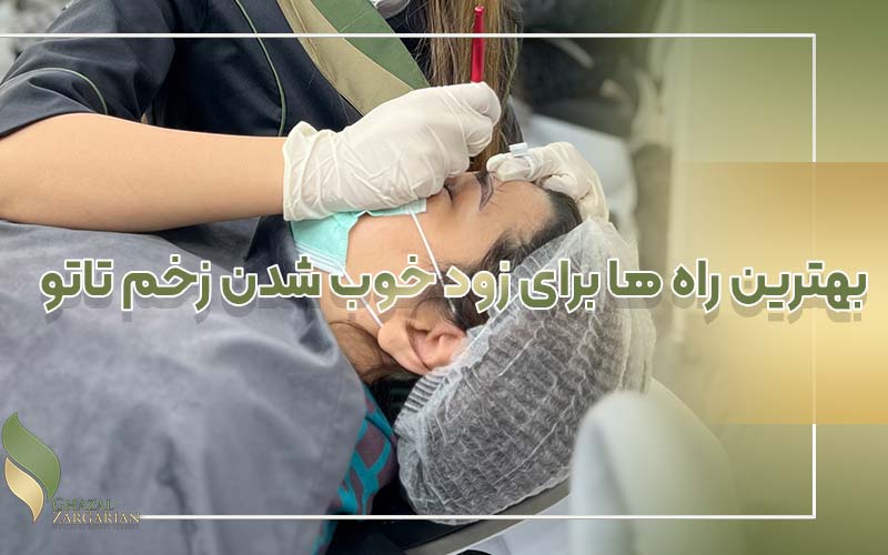 چرا باید زخم تاتو را کند