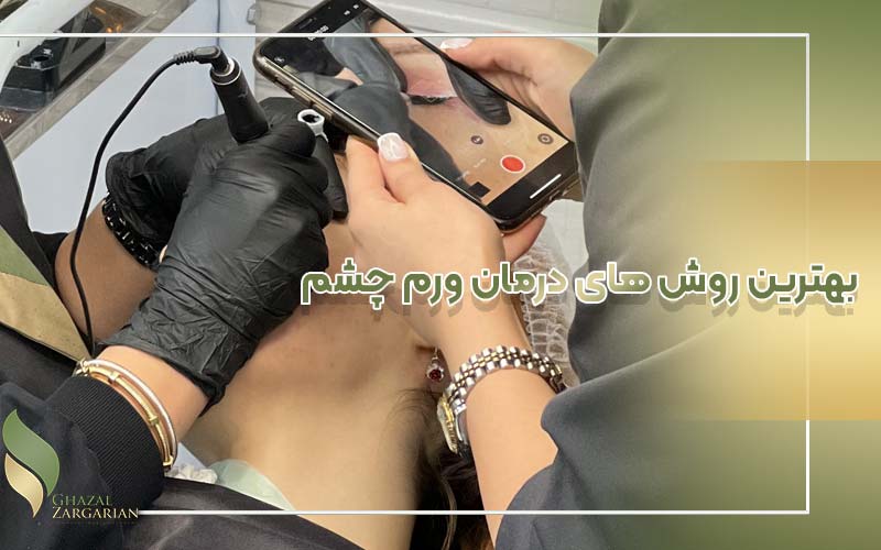 علت ورم چشم بعد از ریموو ابرو