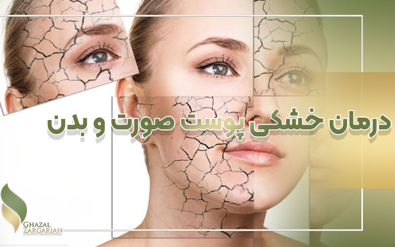 درمان خشکی پوست صورت و بدن با 4 روش کاربردی