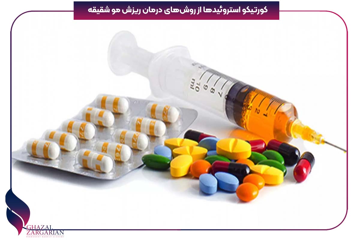 تخمدان پلی کیستیک و ریزش مو 