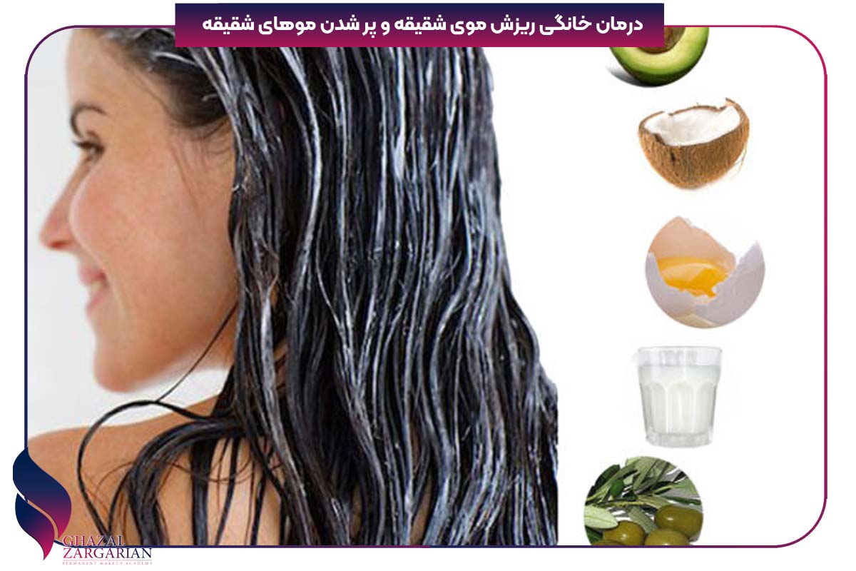 درمان ریزش مو شقیقه مردان