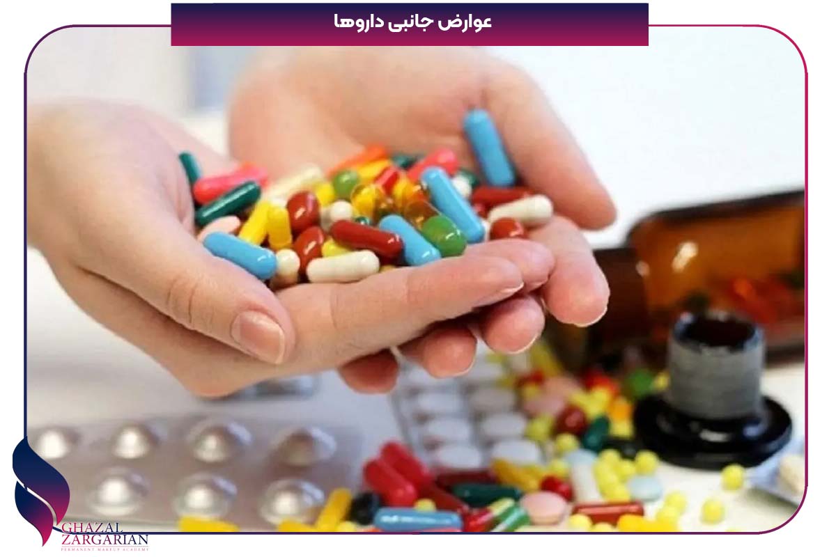 ریزش موی شقیقه