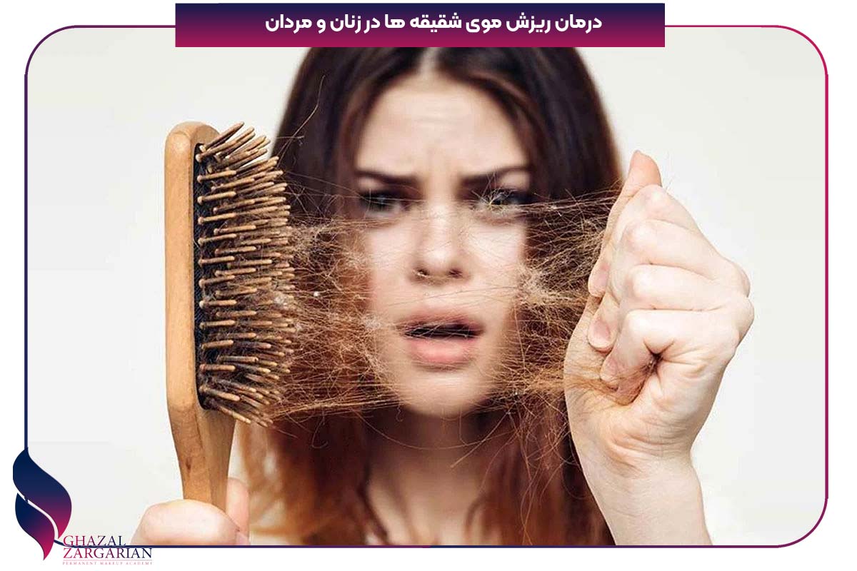 شقیقه سر کجاست