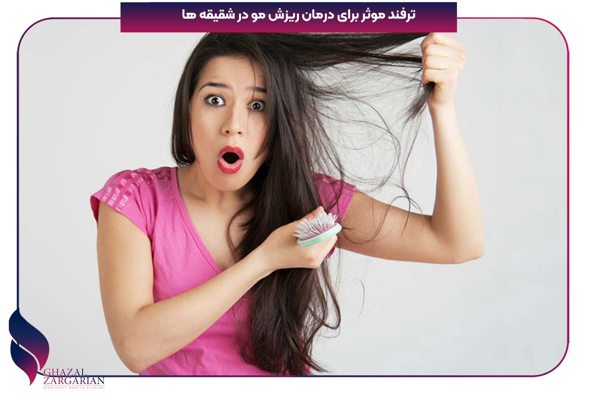 علت ریزش مو شقیقه