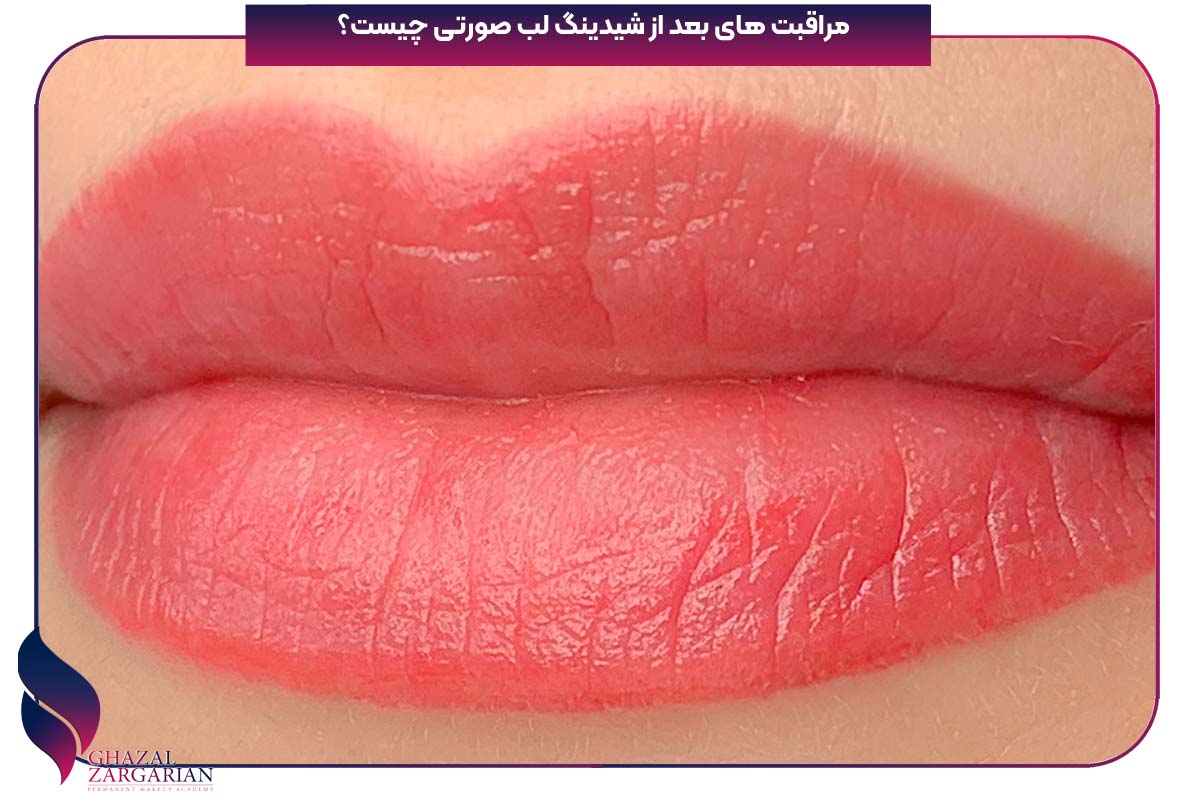 شیدینگ لب بعد یک ماه