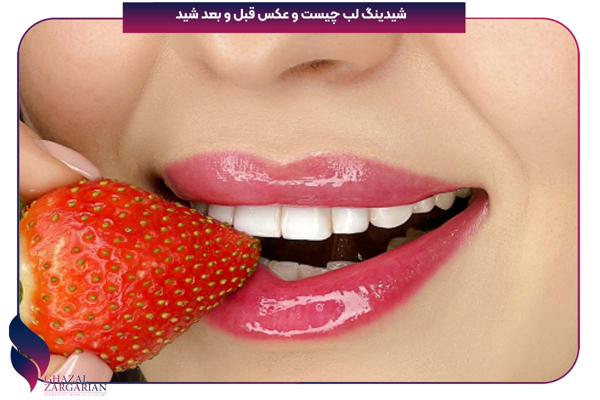شیدینگ لب چیست و عکس قبل و بعد شید