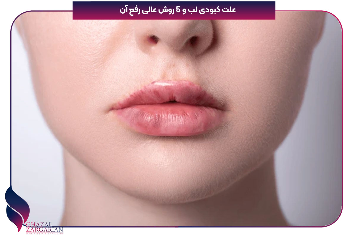 علت کبودی لب