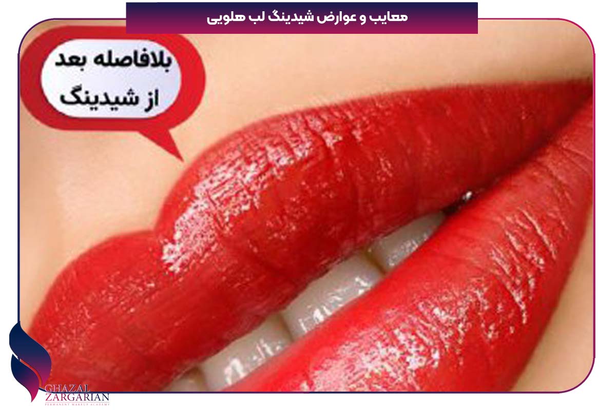 مراقبت بعد شیدینگ لب
