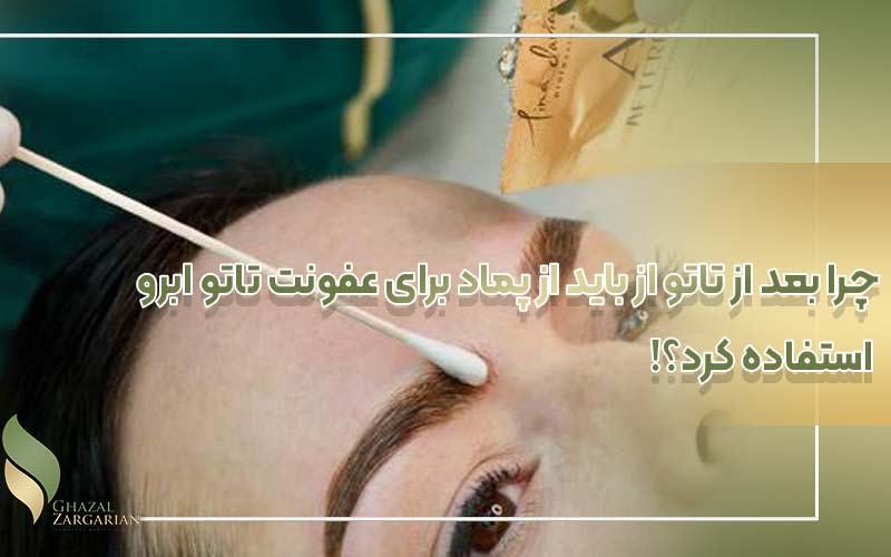 پماد تتراسایکلین برای تاتو بدن