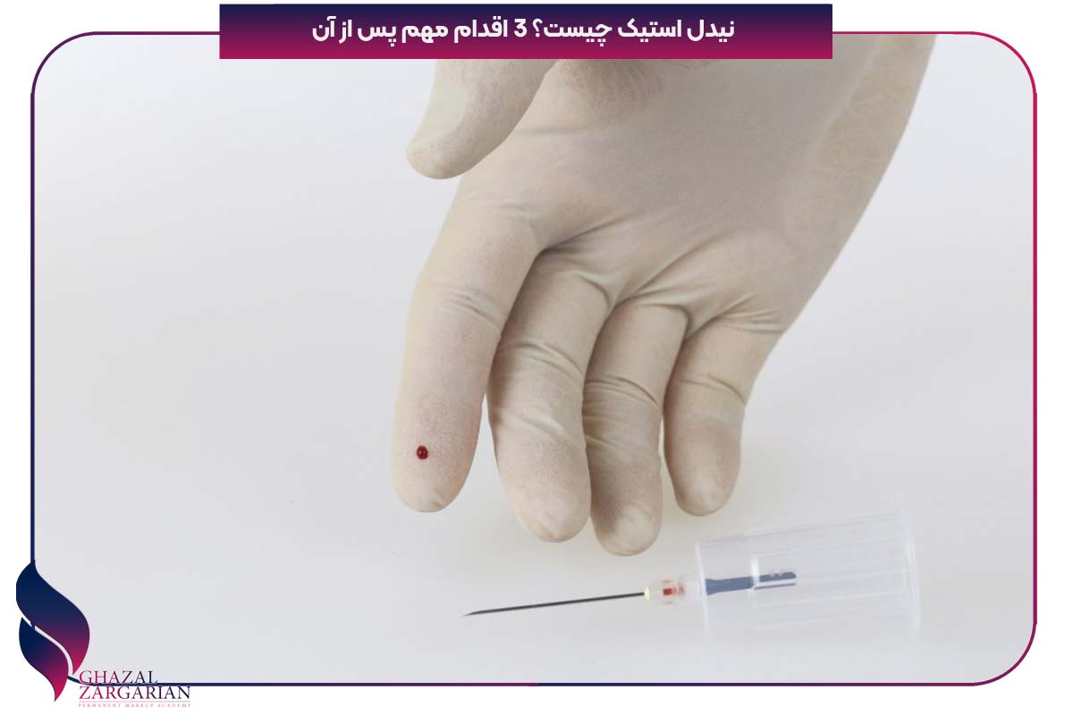 نیدل استیک چیست؟ 3 اقدام مهم پس از آن
