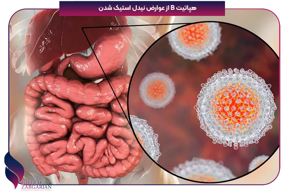 آزمایشات بعد از نیدل استیک شدن