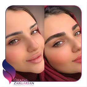 ابروی هاشور