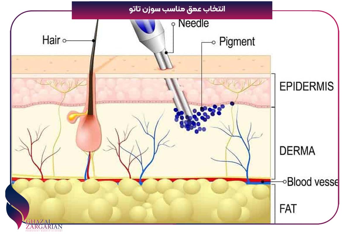 برای کاهش درد تاتو چه باید کرد