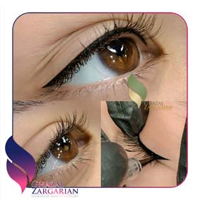 بن مژه بالا و پایین بن مژه بالا و پایین