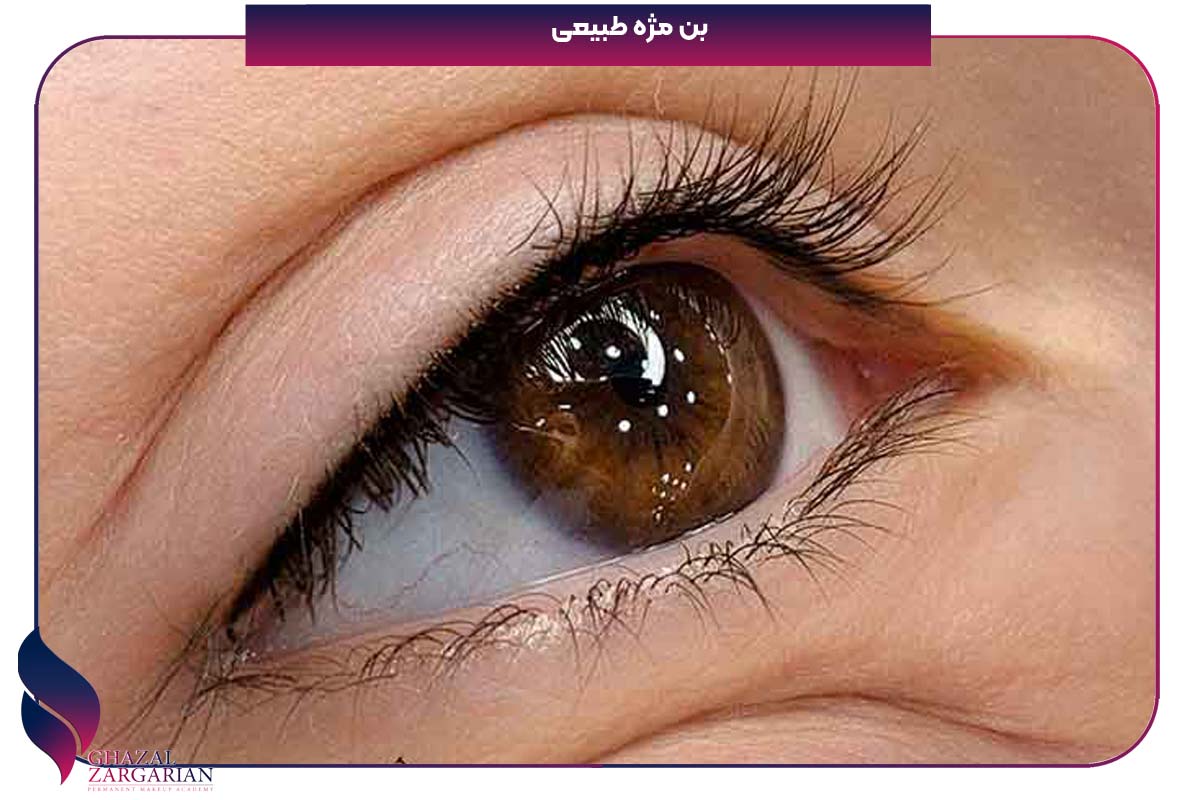 بن مژه دنباله دار