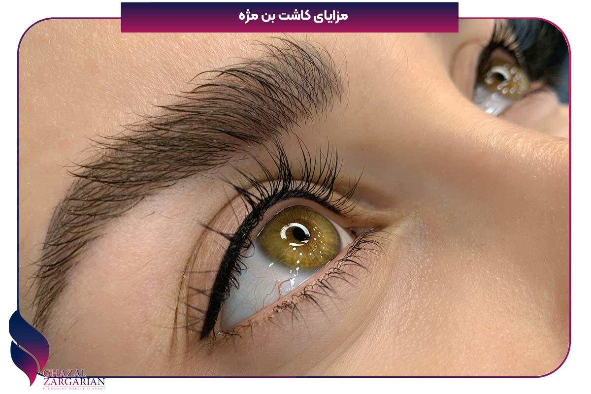 بن مژه زیر چشم