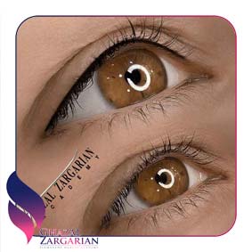 بن مژه ظریف بن مژه ظریف