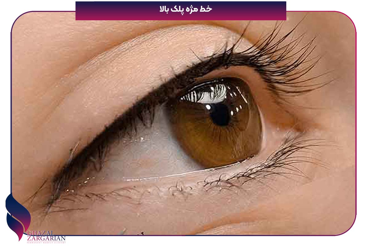 بن مژه قبل و بعد