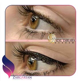 بن مژه پایین چشم بن مژه پایین چشم