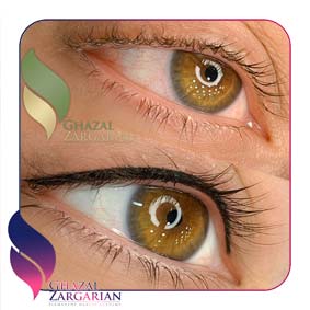 بن مژه چشم بن مژه چشم