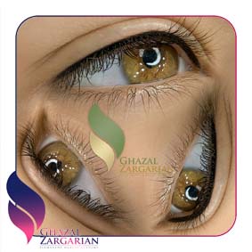 بن مژه چیه بن مژه چیه