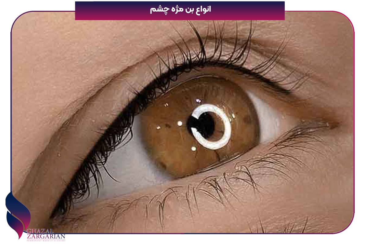 بن مژه