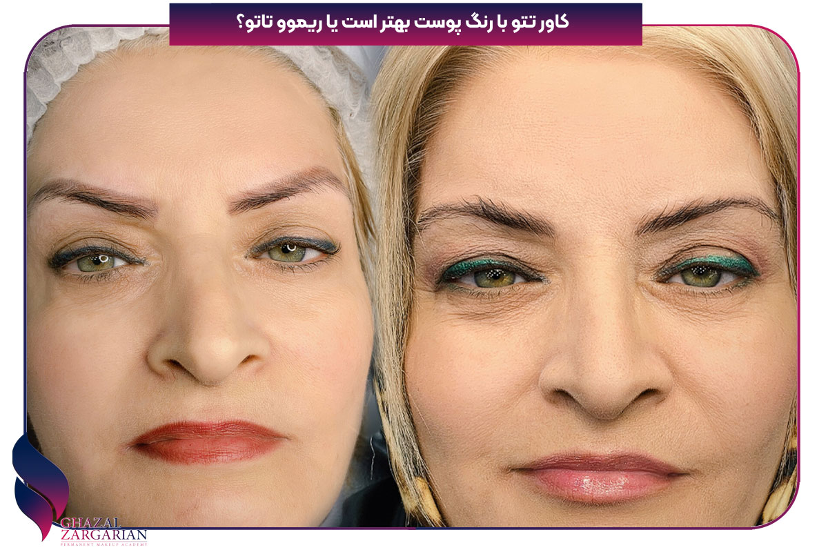تاتو رنگ پوست