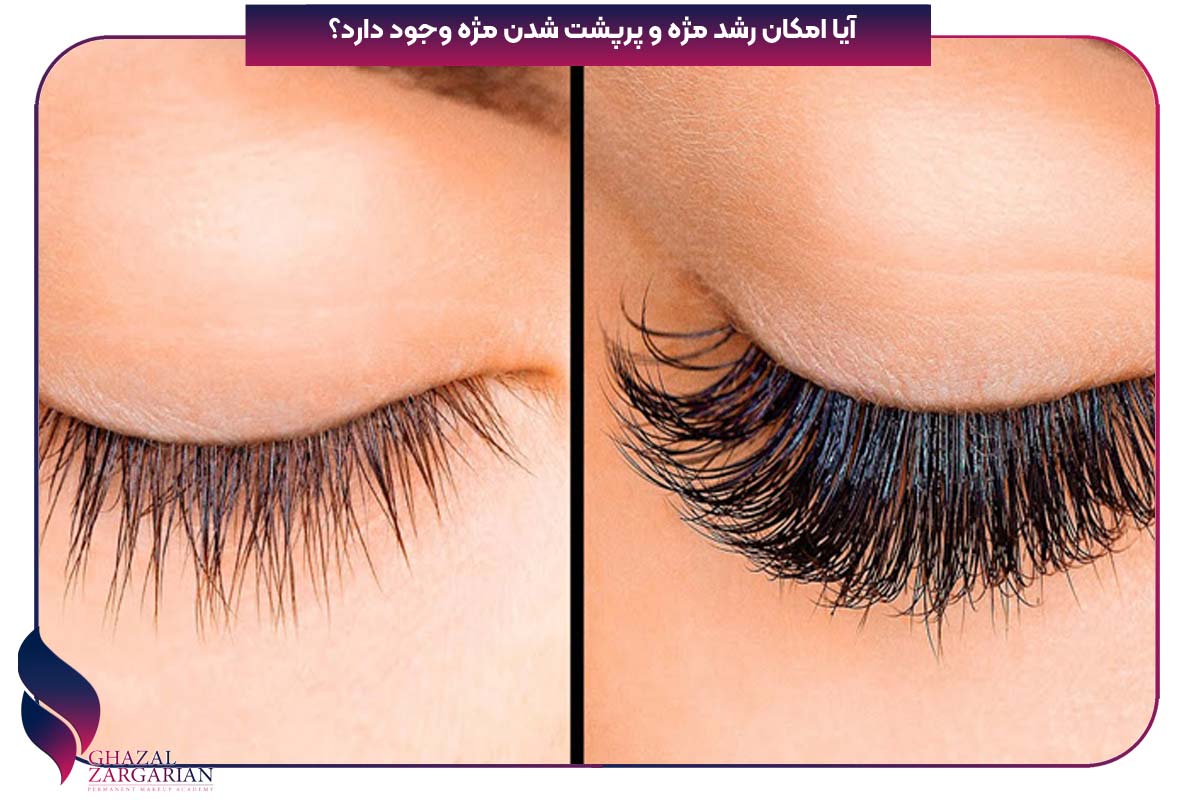 تقویت مژه