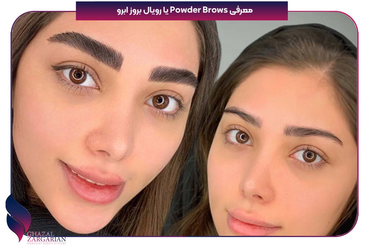 تکنیک رویال بروز