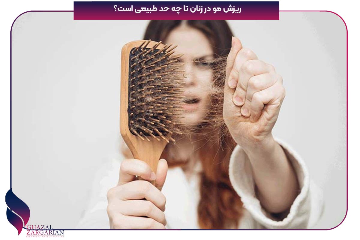 درمان ریزش مو خانگی
