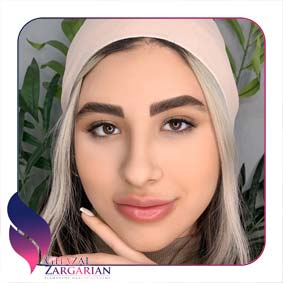 رویال ابرو چیست رویال ابرو چیست
