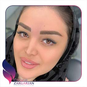 رویال بروز رویال بروز