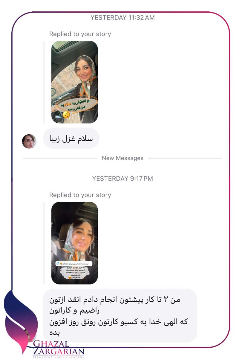 ریمو ابرو چیست ریمو ابرو چیست