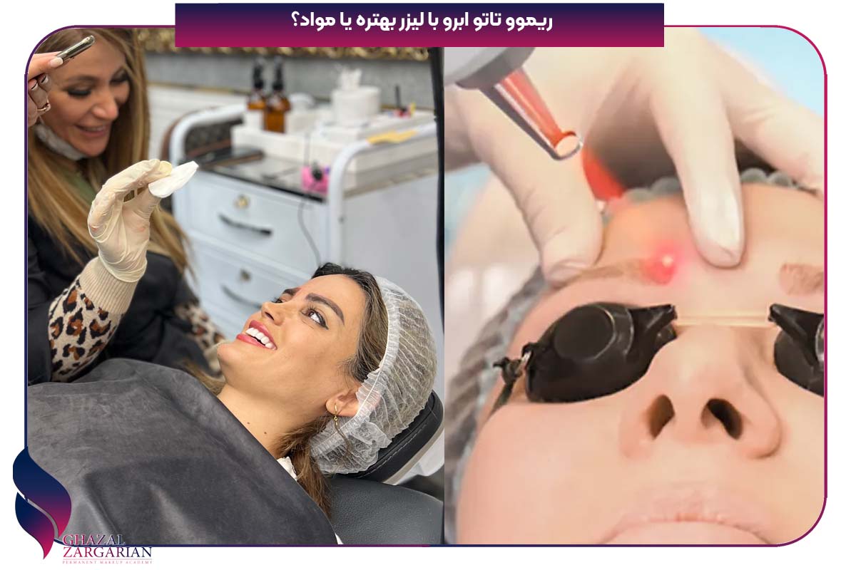 ریموو تاتو ابرو با لیزر بهتره یا مواد؟
