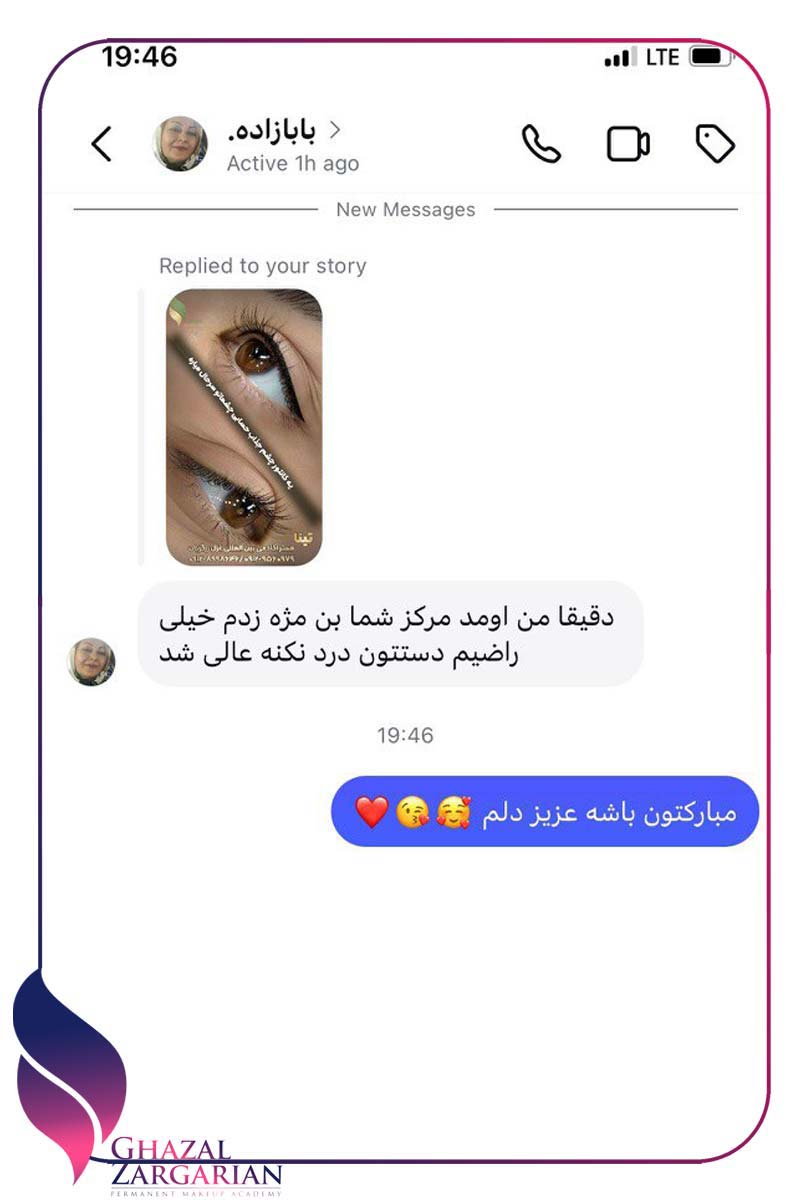 ریموو چیست ریموو چیست