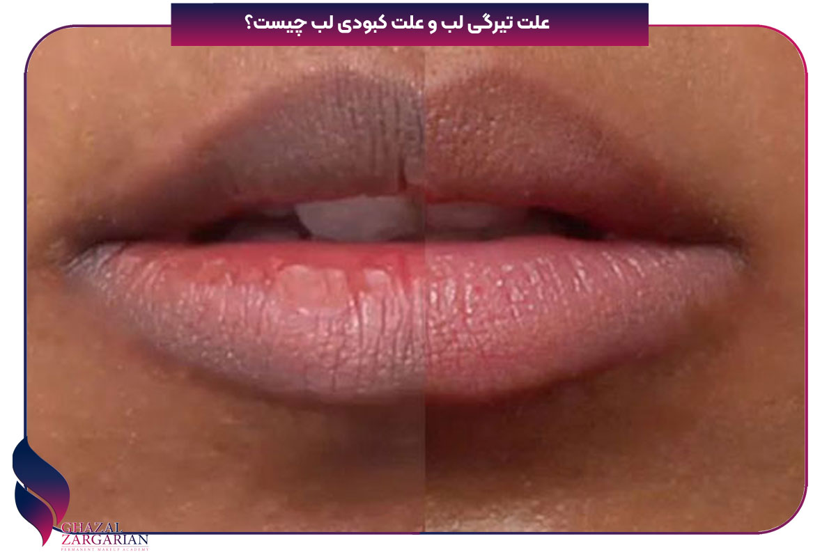 علت کبودی لب زنان نی نی سایت