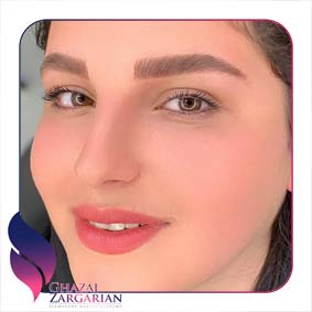 عکس ابرو فیبروز