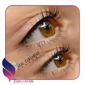 عکس بن مژه عکس بن مژه