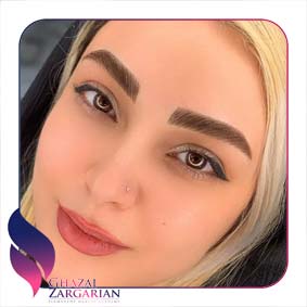 فیبرز ابرو