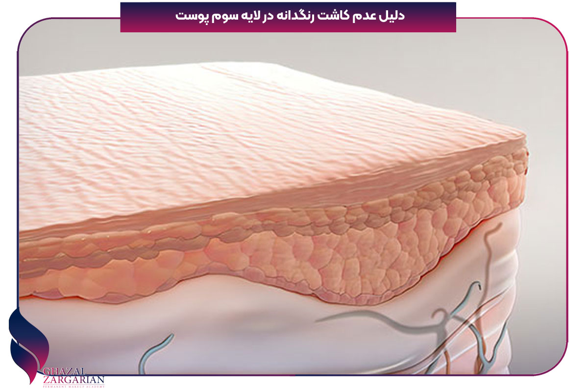 لایه میانی پوست چه نام دارد