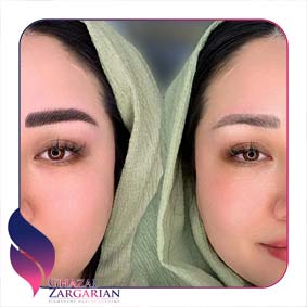 مئل ابرو رویال بروز مئل ابرو رویال بروز