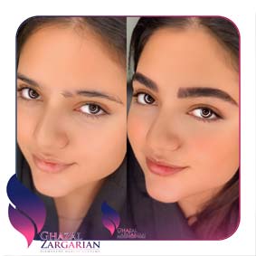 مدل ابرو فیبروز