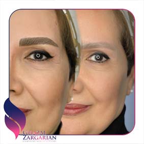 مدل جدید ابرو فیبروز