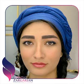 نانو فیبروز