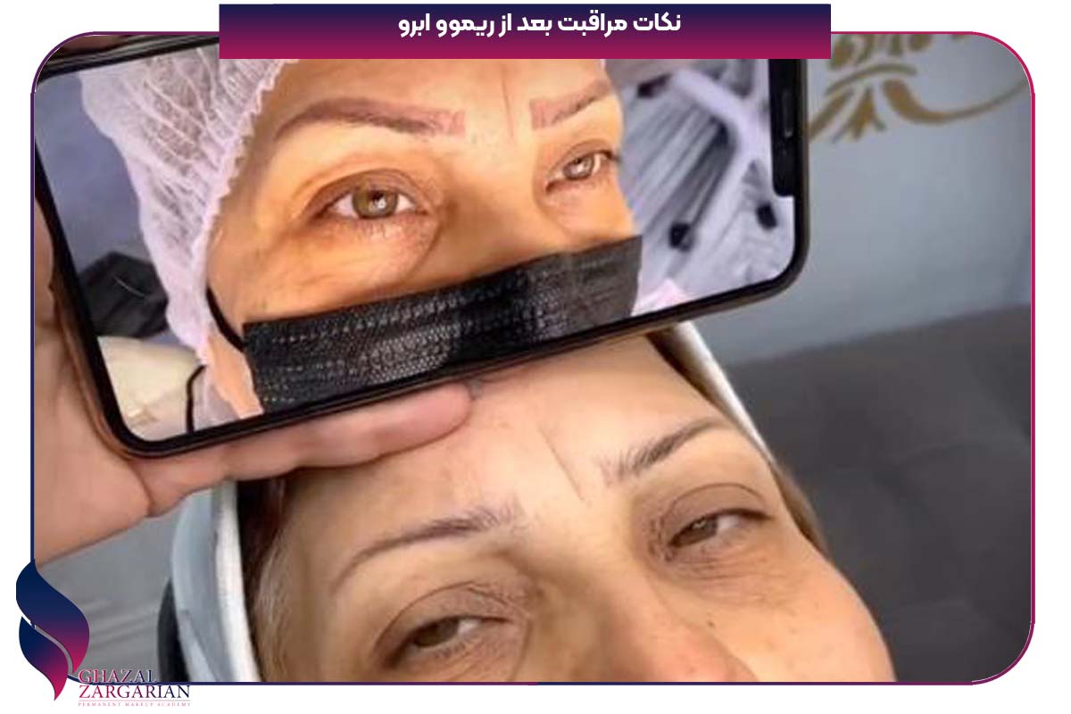 نکات مراقبت بعد از ریموو ابرو