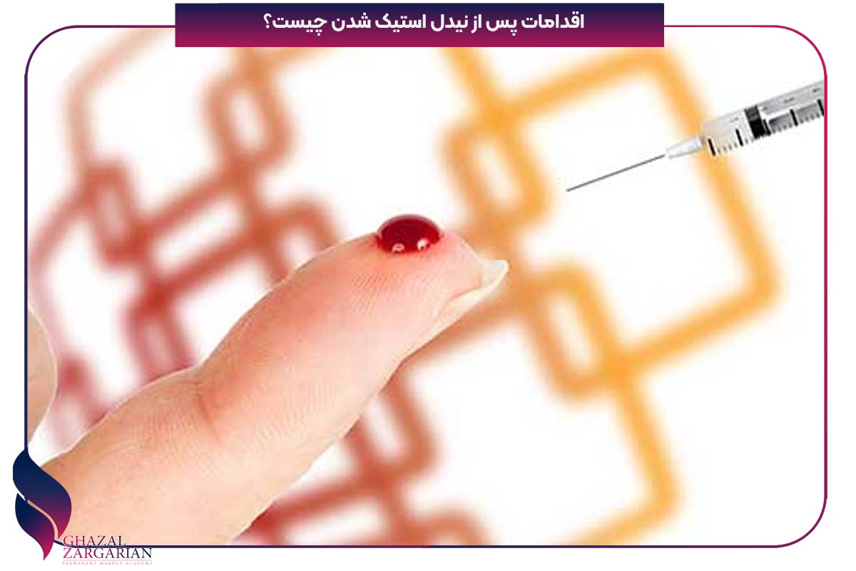 نیدل استیک سطحی